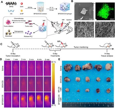 Black phosphorus, an advanced versatile nanoparticles of antitumor, antibacterial and bone regeneration for OS therapy